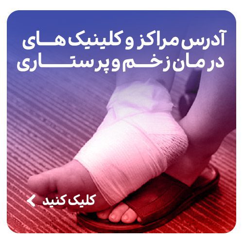 ادرس-کیلک-های-زخم
