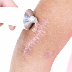 پمادها و ژل های ترمیمی پوست