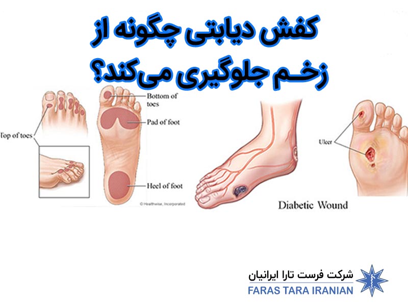 کفش دیابتی چگونه از زخم جلوگیری می‌کند؟