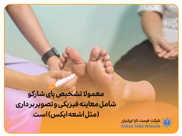 کفش پای شارکو