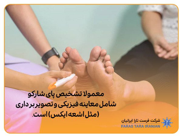 کفش پای شارکو