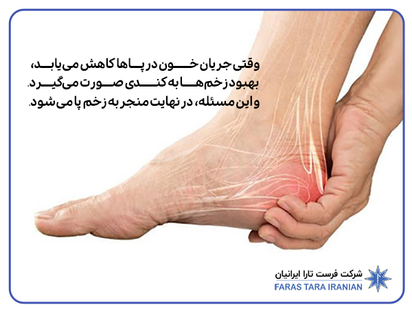 کفش مناسب برای دیابتی ها